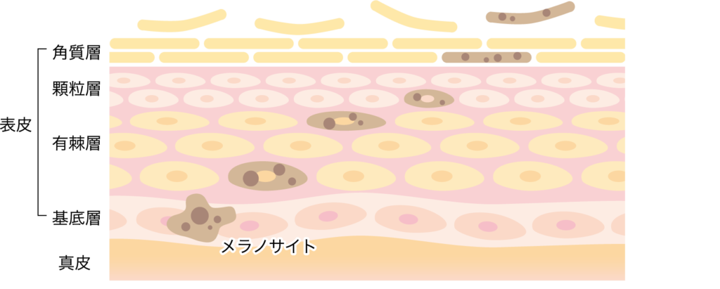 シミの肌断面図