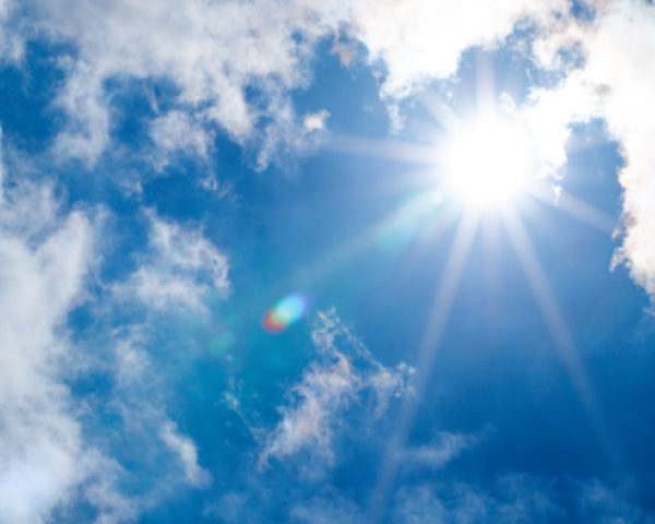 シミができる原因