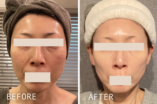 老化肌が若返った肌変化