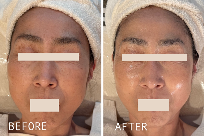 くすみ・ハリ感UPの肌変化