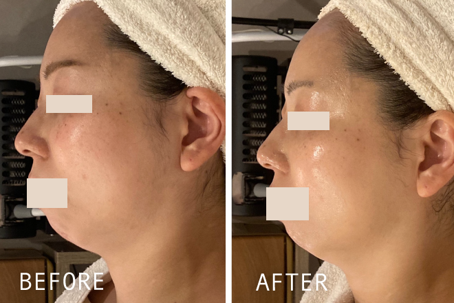 くすみ1回の肌変化