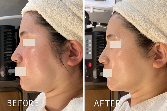 透明感UPの肌変化