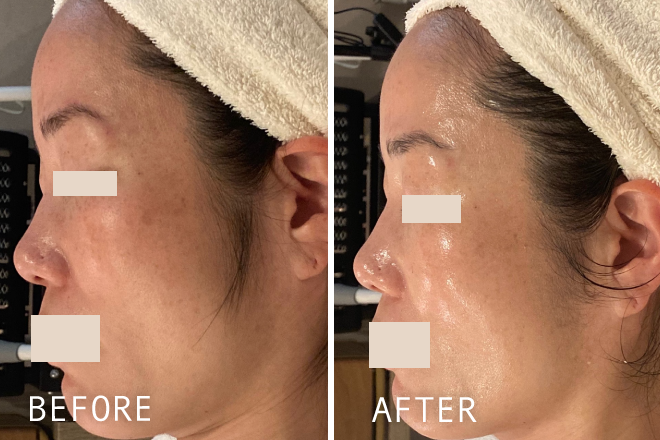 くすみ・透明感が上がった肌変化